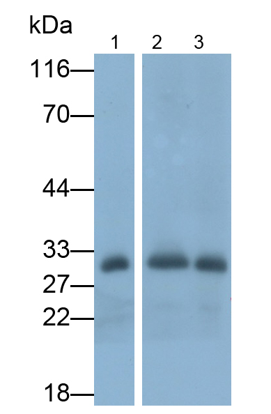 Polyclonal Antibody to Deiodinase, Iodothyronine, Type II (DIO2)