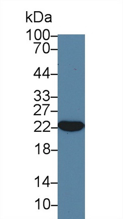 Polyclonal Antibody to Crystallin Alpha B (CRYaB)