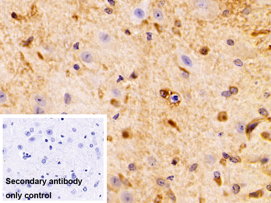 Polyclonal Antibody to Crystallin Alpha B (CRYaB)