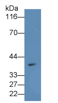 Polyclonal Antibody to Melatonin Receptor 1A (MTNR1A)