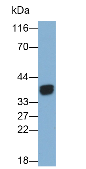 Polyclonal Antibody to Clathrin, Light Polypeptide A (CLTA)