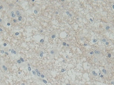 Polyclonal Antibody to Synaptosomal Associated Protein 25kDa (SNAP25)