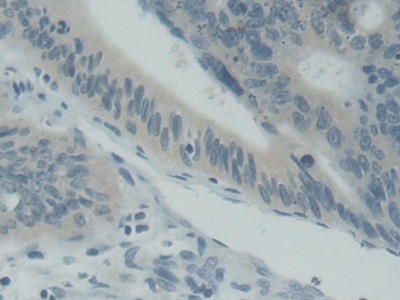 Polyclonal Antibody to Synaptosomal Associated Protein 25kDa (SNAP25)