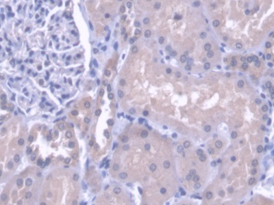 Polyclonal Antibody to Cathepsin H (CTSH)