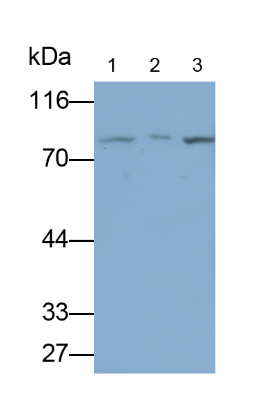 Polyclonal Antibody to Transforming Growth Factor Beta Receptor II (TGFbR2)