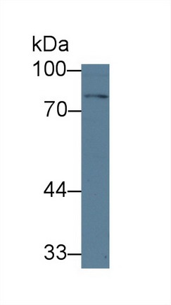 Polyclonal Antibody to Transforming Growth Factor Beta Receptor II (TGFbR2)