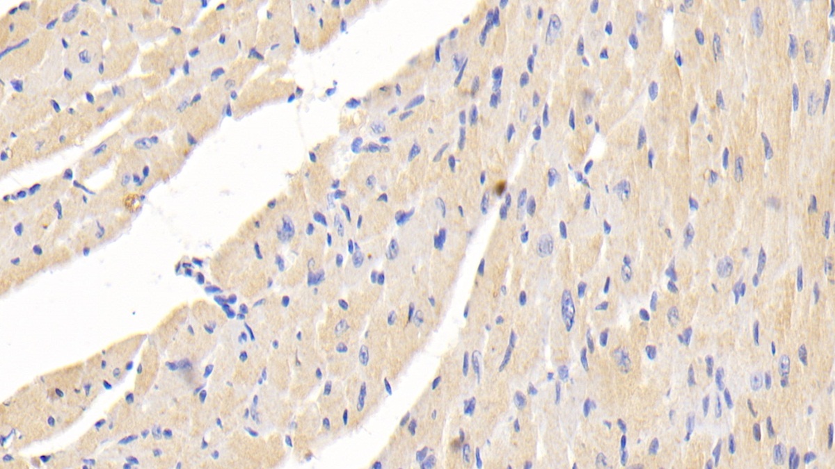 Polyclonal Antibody to Microtubule Associated Protein 1B (MAP1B)