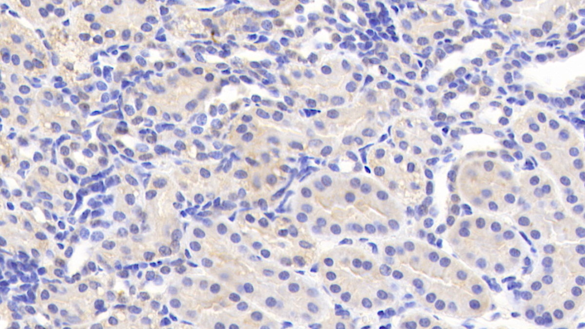 Polyclonal Antibody to Carcinoembryonic Antigen Related Cell Adhesion Molecule 1 (CEACAM1)