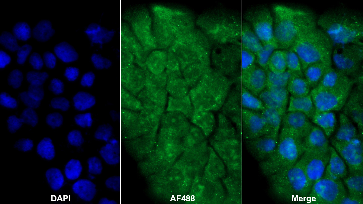 Polyclonal Antibody to Poly ADP Ribose Polymerase 4 (PARP4)