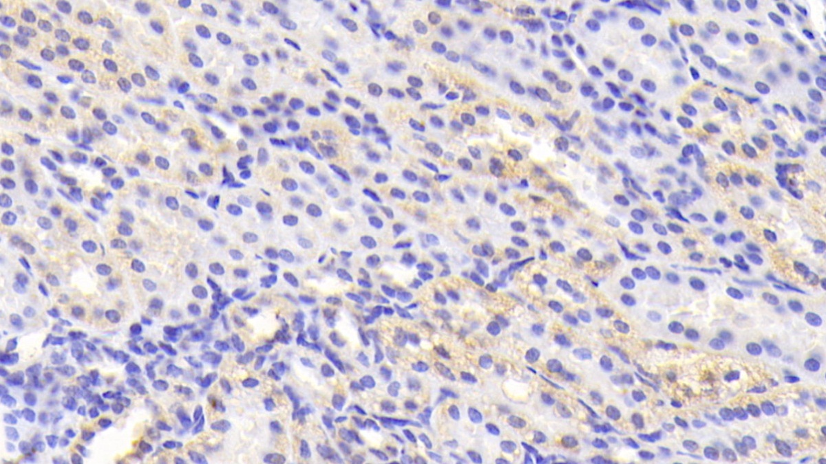 Polyclonal Antibody to Tankyrase 2 (TNKS2)