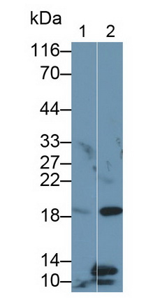 Polyclonal Antibody to Glutathione Peroxidase 4 (GPX4)