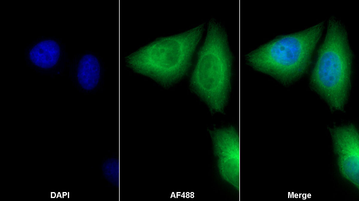 Polyclonal Antibody to Glycyl tRNA Synthetase (GARS)