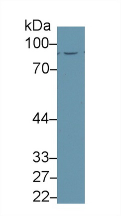 Polyclonal Antibody to Glutaminyl tRNA Synthetase (QARS)