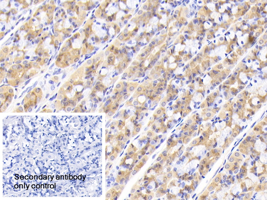 Polyclonal Antibody to Glutaminyl tRNA Synthetase (QARS)