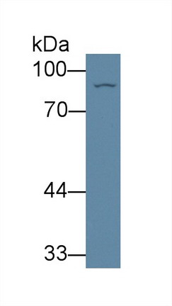 Polyclonal Antibody to Glutaminyl tRNA Synthetase (QARS)