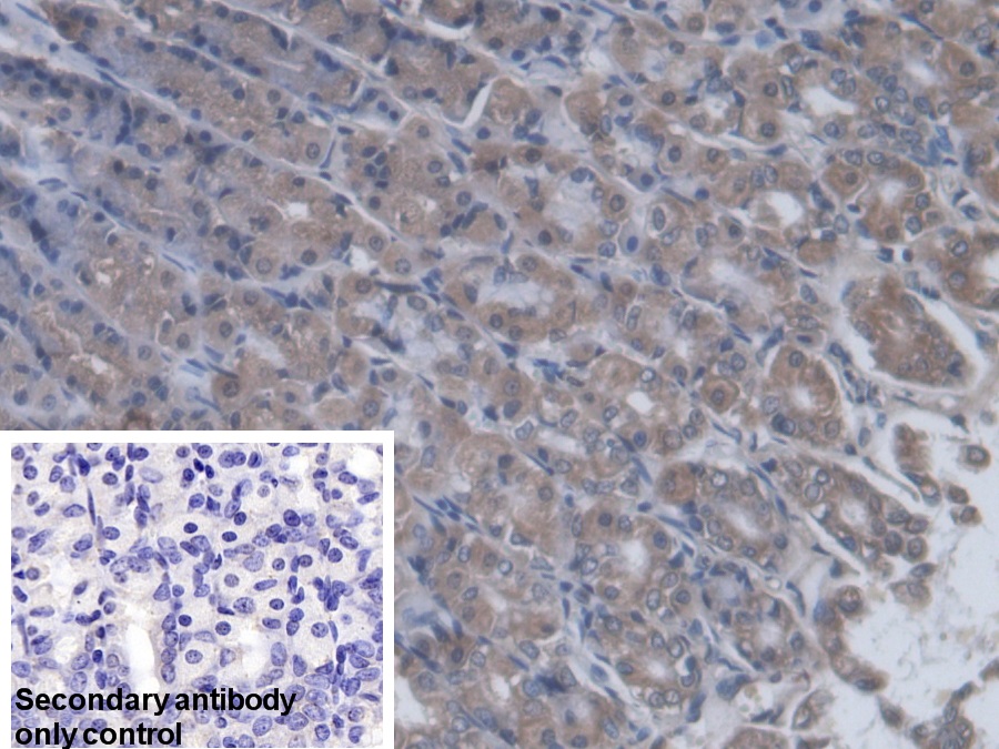 Polyclonal Antibody to Glutaminyl tRNA Synthetase (QARS)