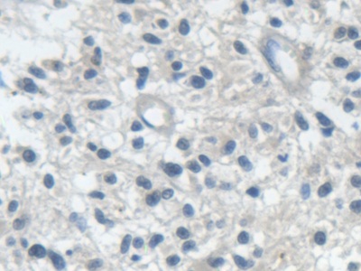 Polyclonal Antibody to Isoleucyl tRNA Synthetase (IARS)