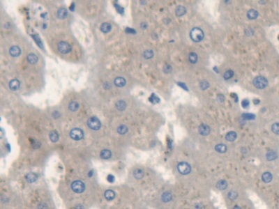 Polyclonal Antibody to Isoleucyl tRNA Synthetase (IARS)