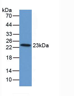 Polyclonal Antibody to Ferritin, Light Polypeptide (FTL)