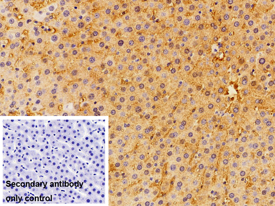 Polyclonal Antibody to Ferritin, Heavy Polypeptide (FTH)