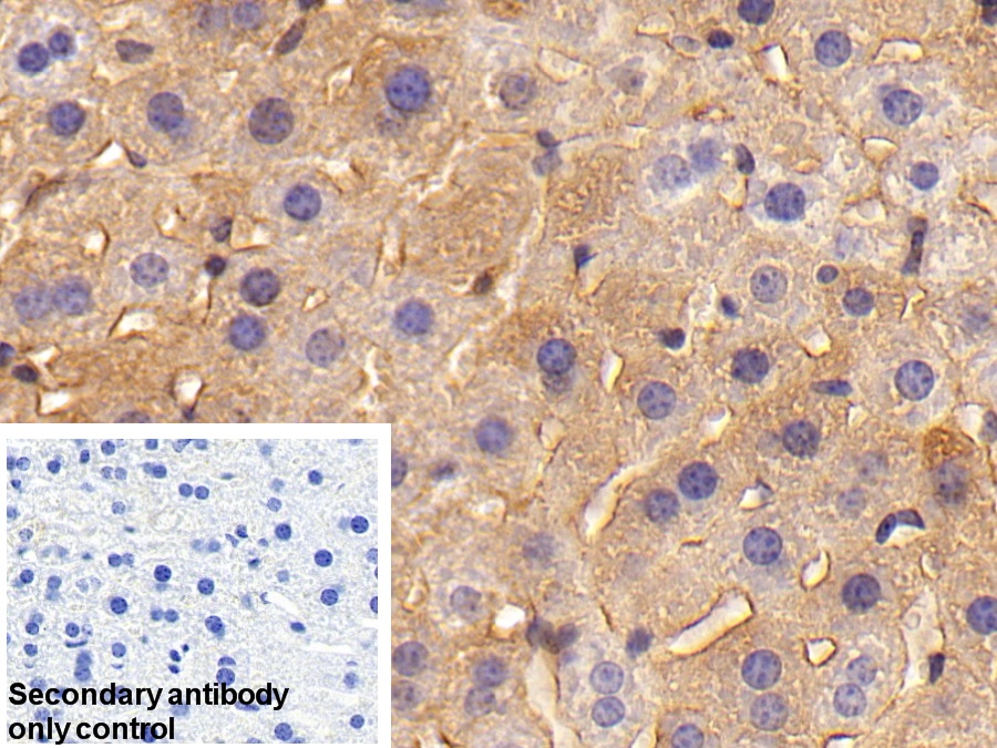 Polyclonal Antibody to Ferritin, Heavy Polypeptide (FTH)