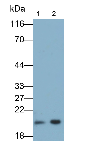 Polyclonal Antibody to Ferritin, Heavy Polypeptide (FTH)