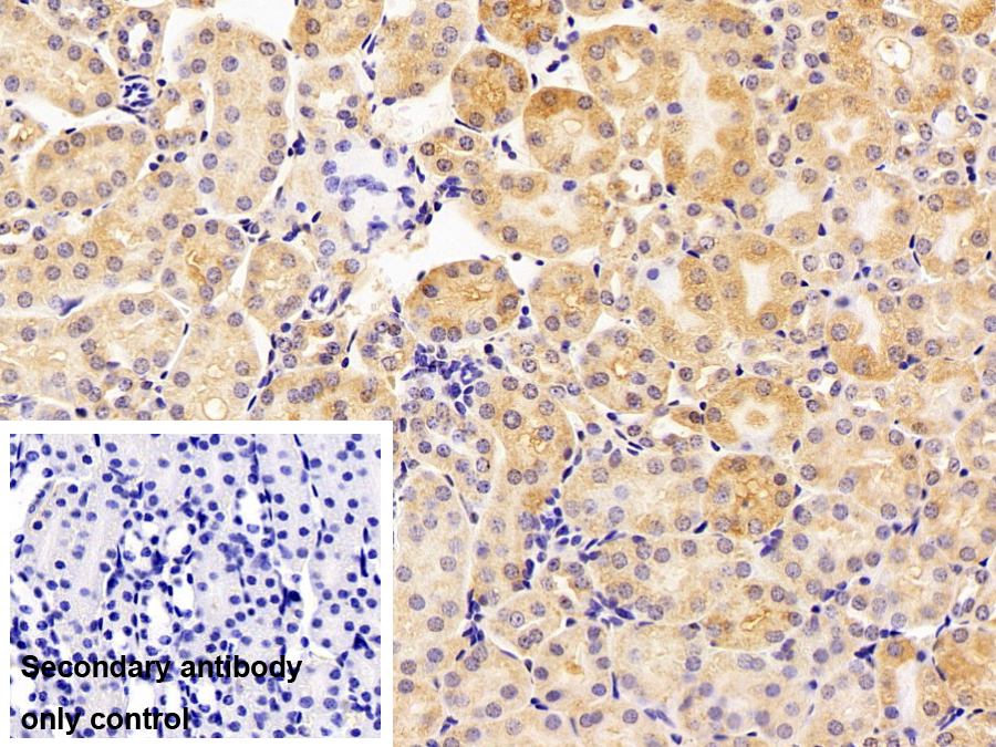 Polyclonal Antibody to Ferritin, Heavy Polypeptide (FTH)