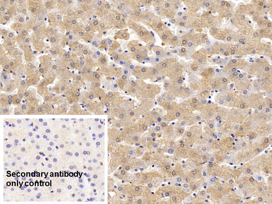 Polyclonal Antibody to Ferritin, Heavy Polypeptide (FTH)