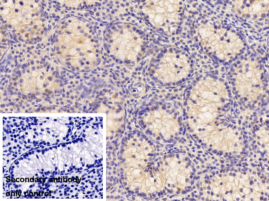 Polyclonal Antibody to Heat Shock 70kDa Protein 2 (HSPA2)