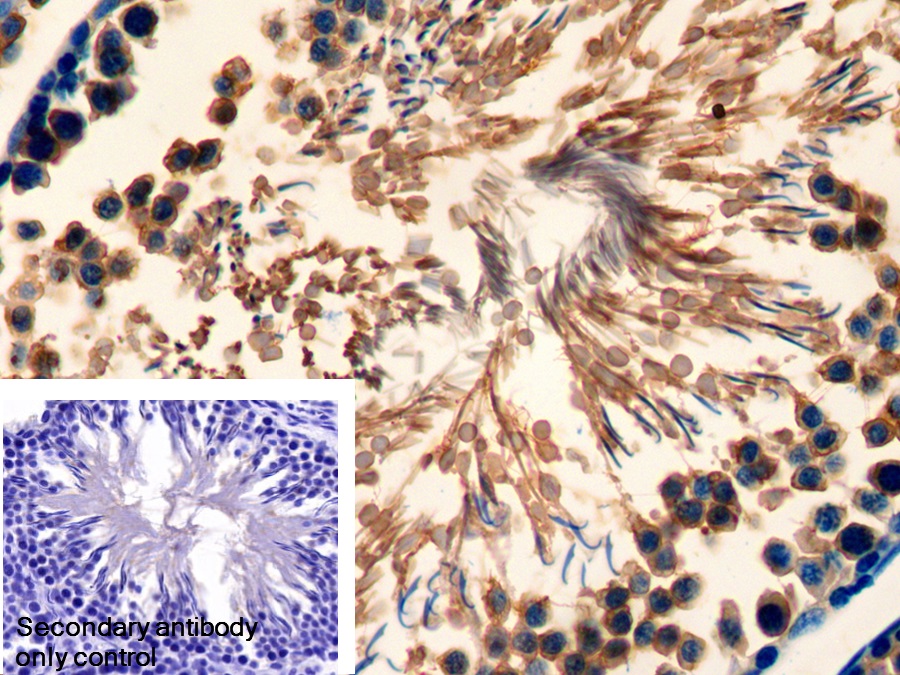 Polyclonal Antibody to Heat Shock 70kDa Protein 2 (HSPA2)