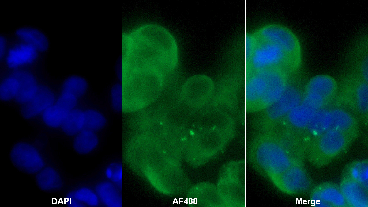 Polyclonal Antibody to Heat Shock 70kDa Protein 8 (HSPA8)