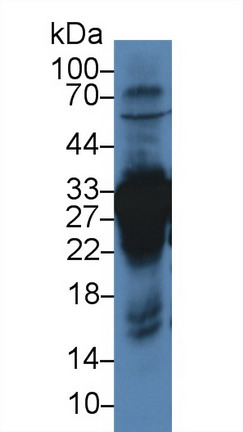 Polyclonal Antibody to Carbonic Anhydrase III, Muscle Specific (CA3)