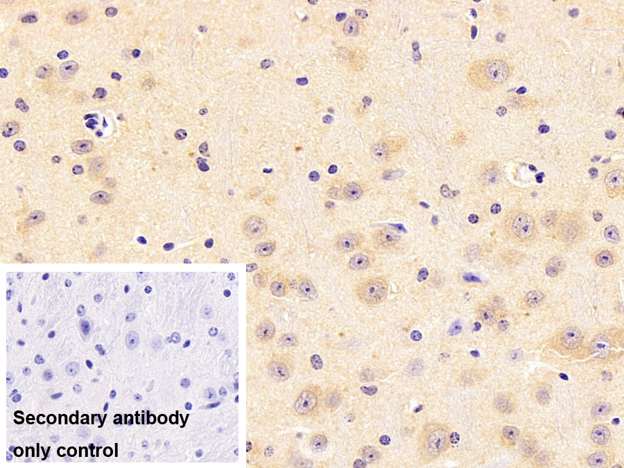 Polyclonal Antibody to Carbonic Anhydrase VIII (CA8)