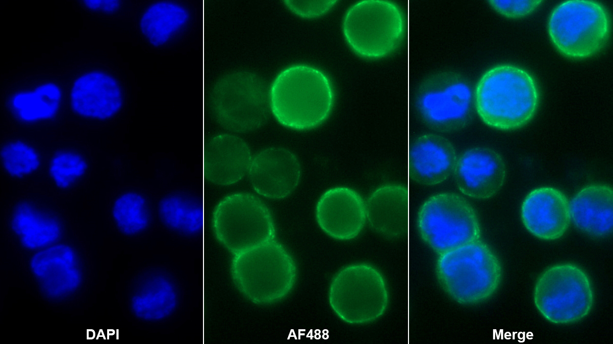 Polyclonal Antibody to Carbonic Anhydrase IX (CA9)