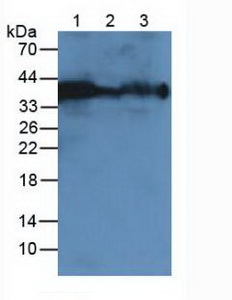 Polyclonal Antibody to Carbonic Anhydrase XII (CA12)