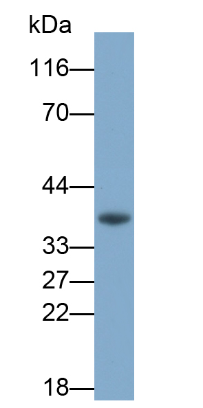 Polyclonal Antibody to Carbonic Anhydrase XII (CA12)