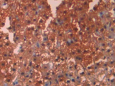 Polyclonal Antibody to Carbonic Anhydrase XII (CA12)