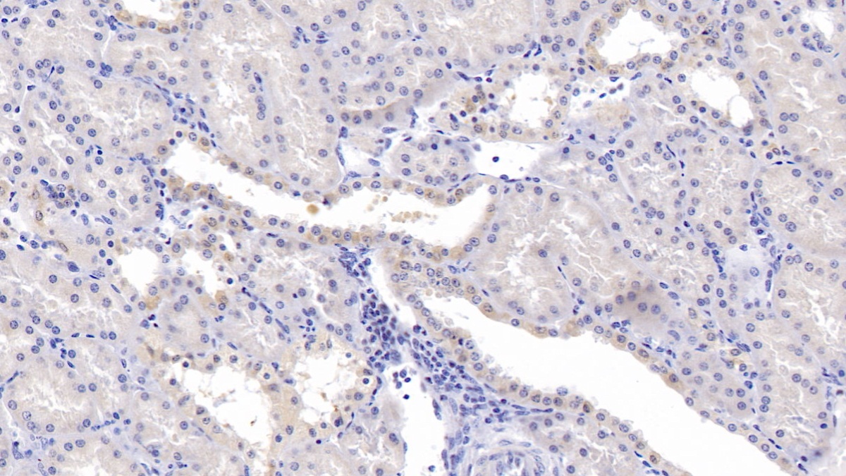 Polyclonal Antibody to Carbonic Anhydrase XIII (CA13)