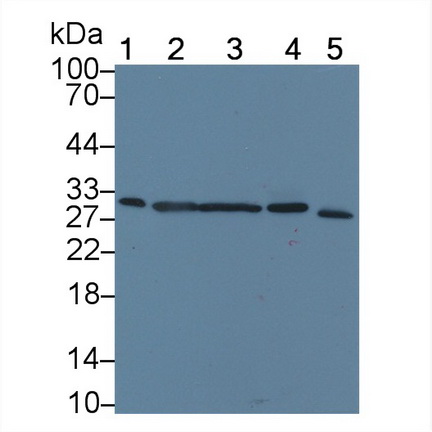 Polyclonal Antibody to Carbonic Anhydrase XIII (CA13)