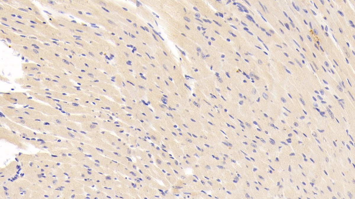 Polyclonal Antibody to Carbonic Anhydrase XIII (CA13)
