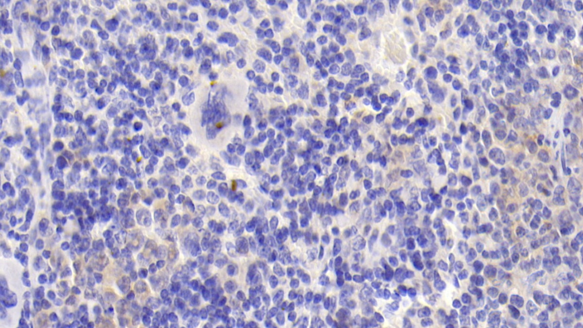 Polyclonal Antibody to Carbonic Anhydrase XIII (CA13)