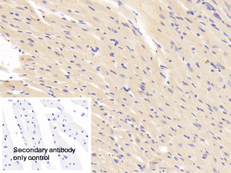 Polyclonal Antibody to Carbonic Anhydrase XIII (CA13)