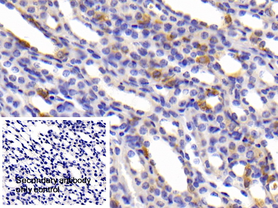 Polyclonal Antibody to Carbonic Anhydrase XIII (CA13)