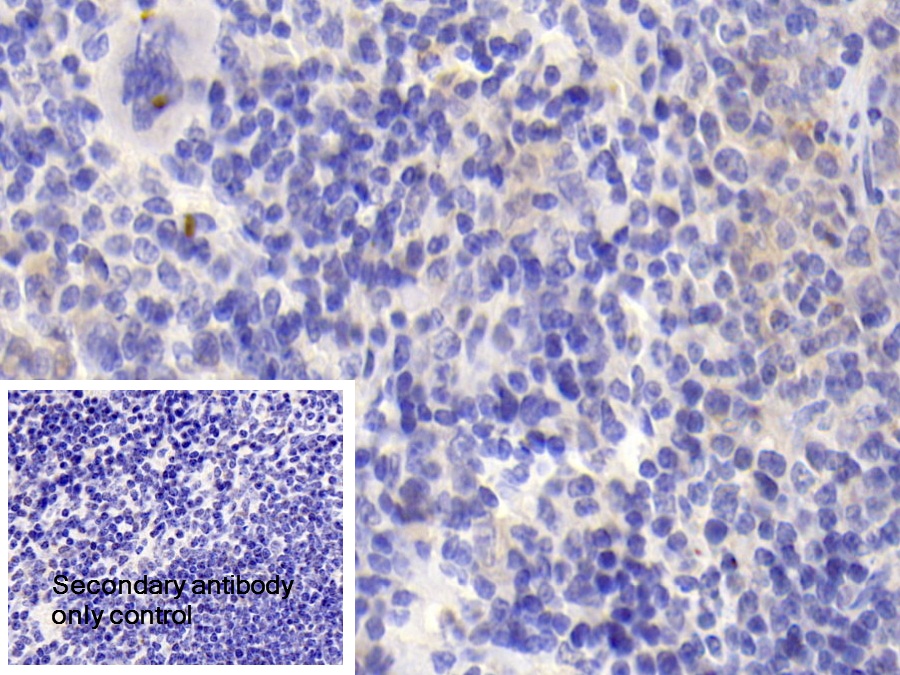 Polyclonal Antibody to Carbonic Anhydrase XIII (CA13)