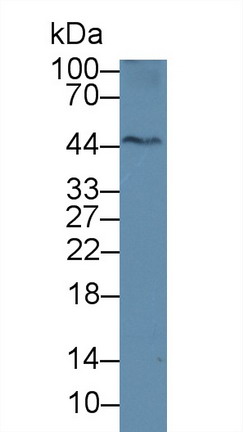 Polyclonal Antibody to Acid Phosphatase 6, Lysophosphatidic (ACP6)