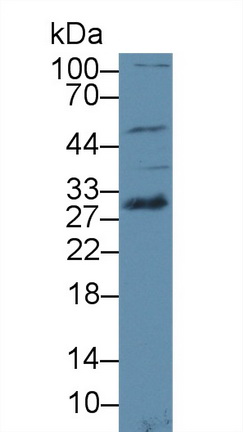 Polyclonal Antibody to Acid Phosphatase 6, Lysophosphatidic (ACP6)