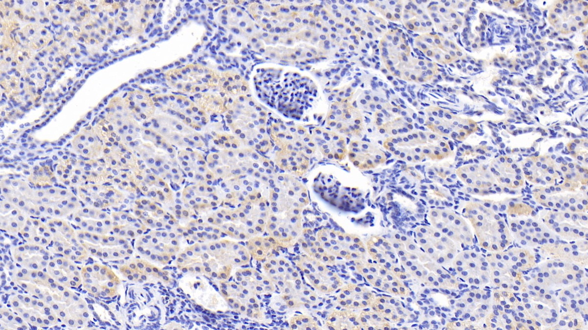 Polyclonal Antibody to Acid Phosphatase 6, Lysophosphatidic (ACP6)