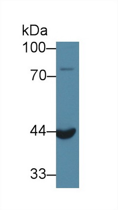 Polyclonal Antibody to Acid Phosphatase 6, Lysophosphatidic (ACP6)