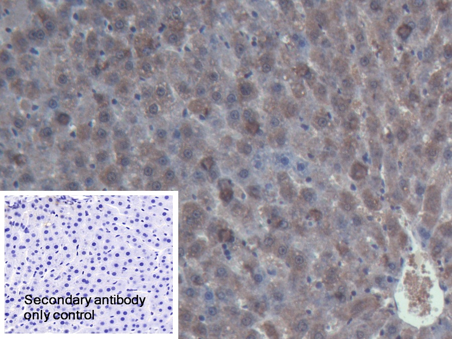 Polyclonal Antibody to Acid Phosphatase 6, Lysophosphatidic (ACP6)