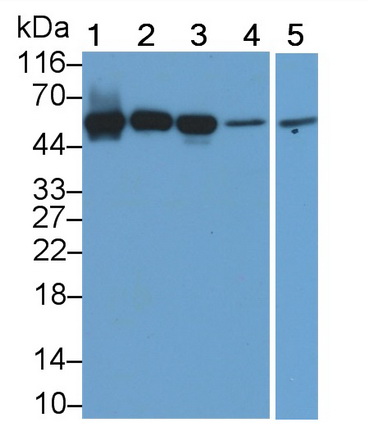 Polyclonal Antibody to Acid Phosphatase 2, Lysosomal (ACP2)